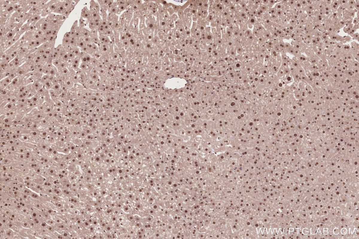 Immunohistochemical analysis of paraffin-embedded mouse liver tissue slide using KHC2735 (STAG1 IHC Kit).