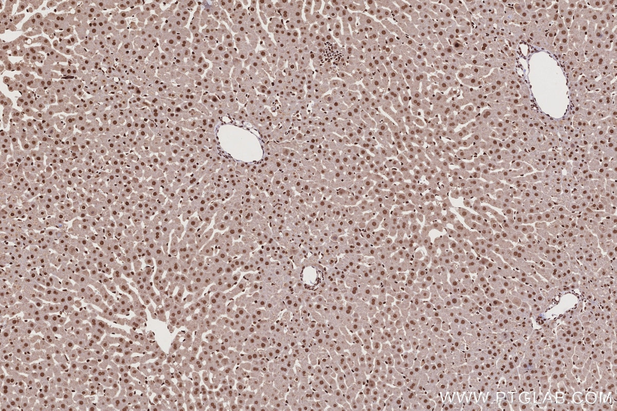 Immunohistochemical analysis of paraffin-embedded rat liver tissue slide using KHC2735 (STAG1 IHC Kit).