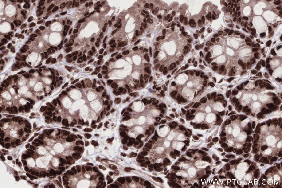 Immunohistochemical analysis of paraffin-embedded rat colon tissue slide using KHC2673 (STAG2 IHC Kit).