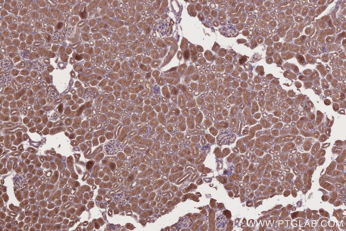 Immunohistochemical analysis of paraffin-embedded mouse kidney tissue slide using KHC2754 (STAM IHC Kit).