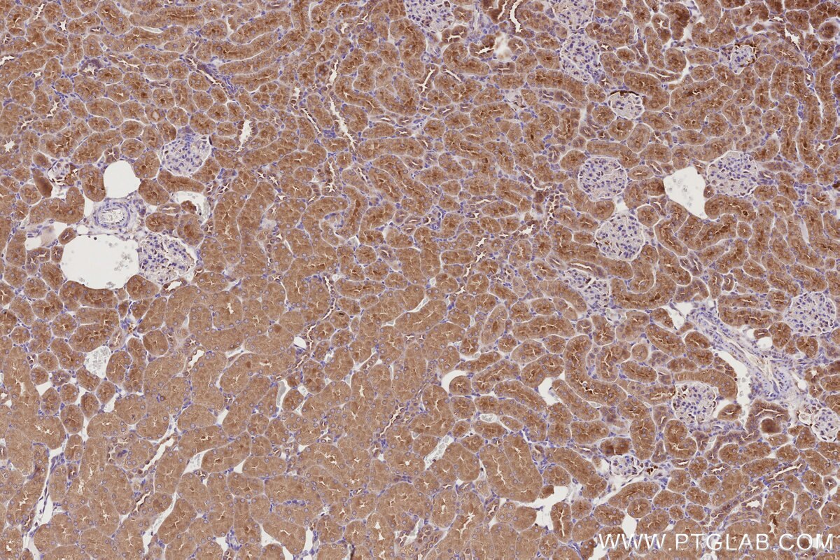 Immunohistochemical analysis of paraffin-embedded rat kidney tissue slide using KHC2754 (STAM IHC Kit).
