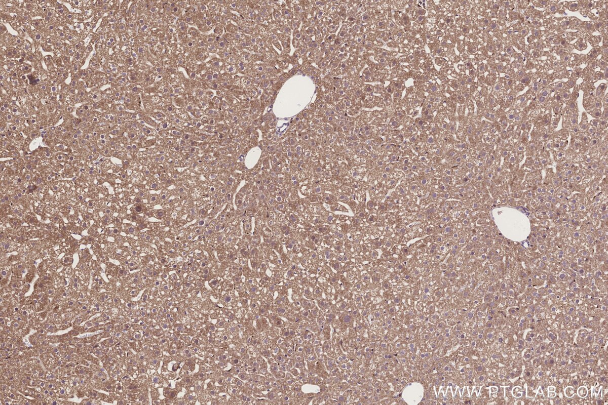 Immunohistochemical analysis of paraffin-embedded mouse liver tissue slide using KHC3253 (STARD3/MLN64 IHC Kit).