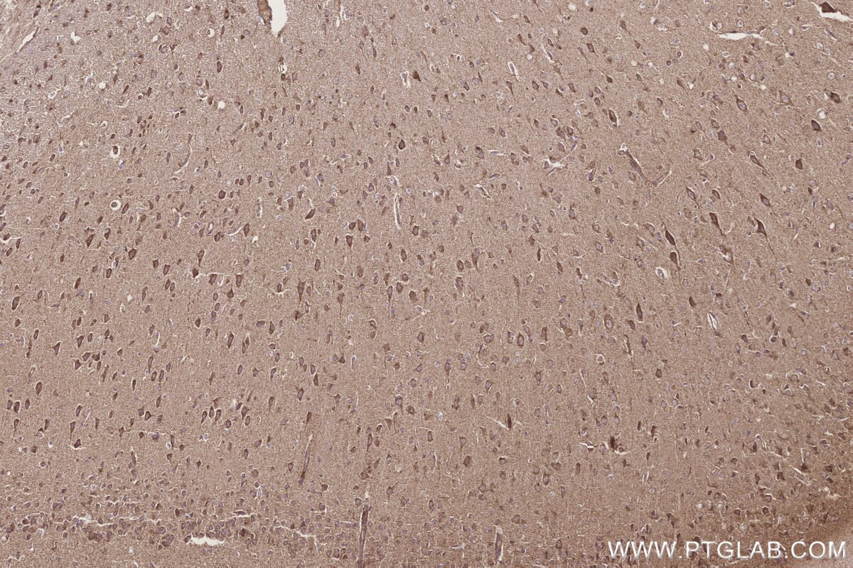 Immunohistochemical analysis of paraffin-embedded rat brain tissue slide using KHC3253 (STARD3/MLN64 IHC Kit).