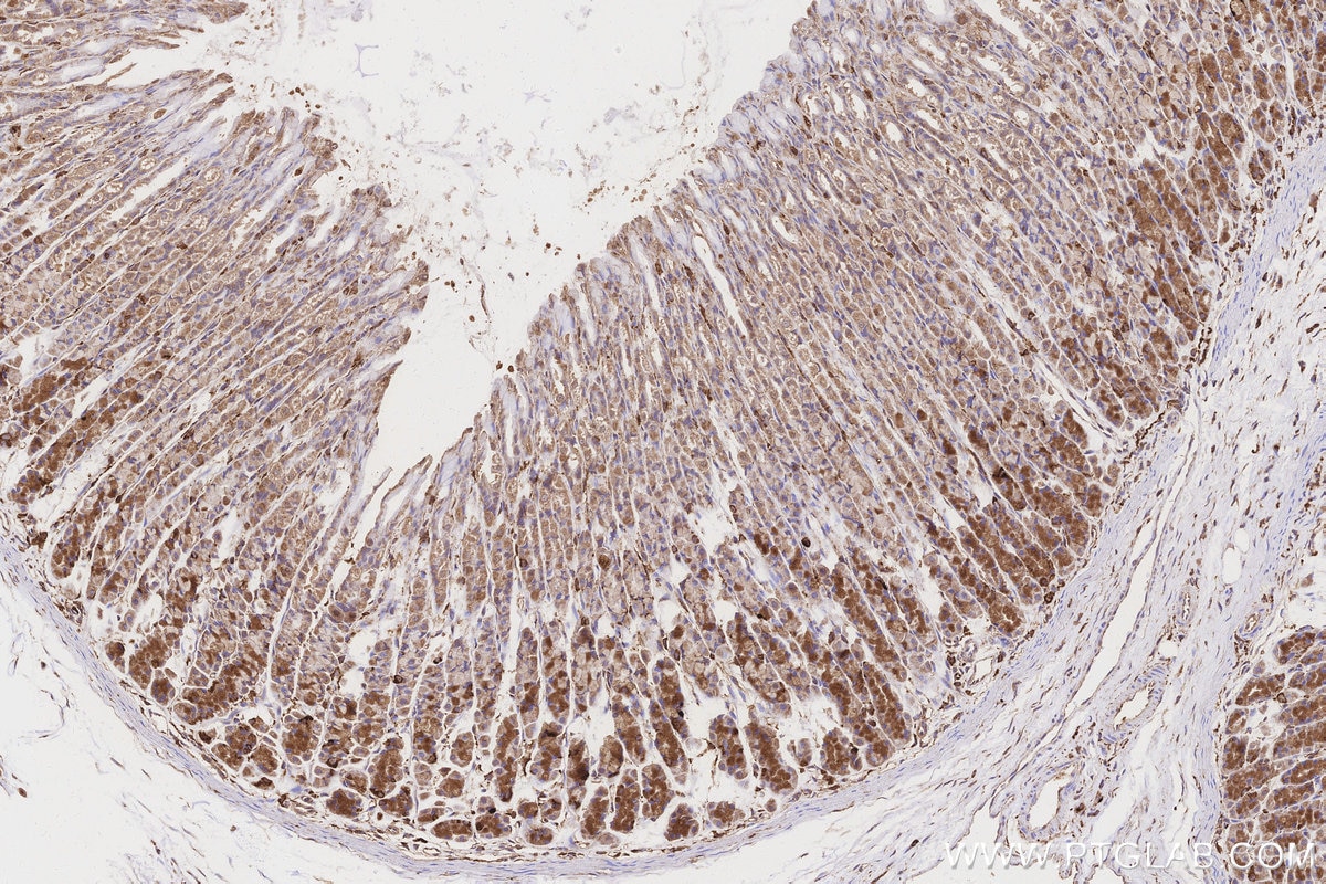 Immunohistochemical analysis of paraffin-embedded rat stomach tissue slide using KHC3157 (STARD3NL IHC Kit).
