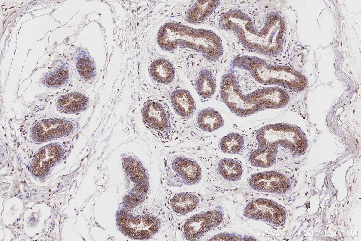 Immunohistochemical analysis of paraffin-embedded rat epididymis tissue slide using KHC3157 (STARD3NL IHC Kit).