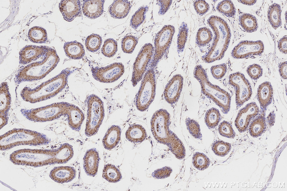 Immunohistochemical analysis of paraffin-embedded mouse epididymis tissue slide using KHC3157 (STARD3NL IHC Kit).