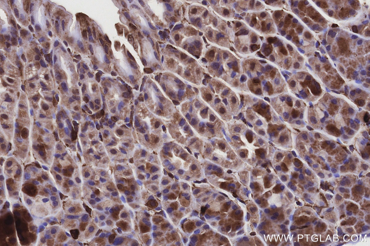 Immunohistochemical analysis of paraffin-embedded mouse stomach tissue slide using KHC3157 (STARD3NL IHC Kit).