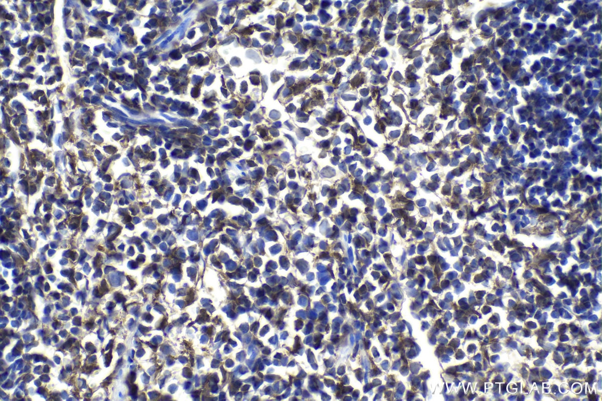 Immunohistochemical analysis of paraffin-embedded mouse spleen tissue slide using KHC1036 (STAT1 IHC Kit).