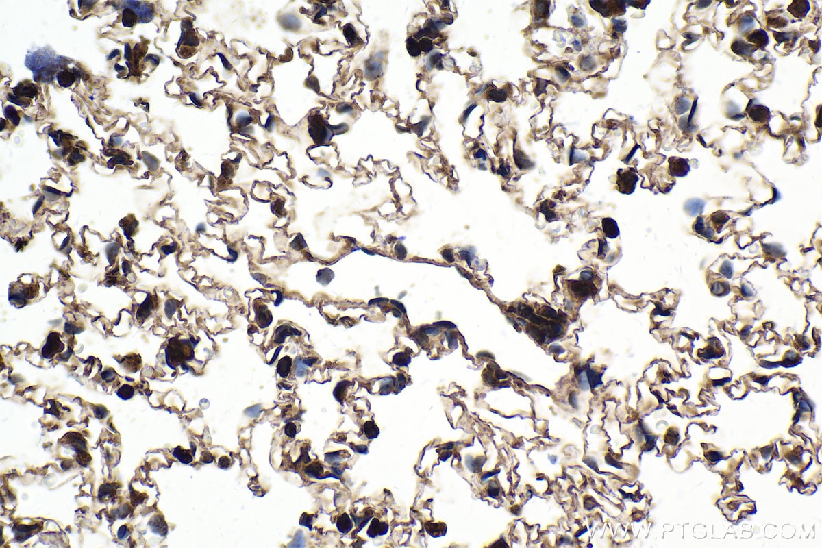 Immunohistochemical analysis of paraffin-embedded rat lung tissue slide using KHC1622 (STAT2 IHC Kit).