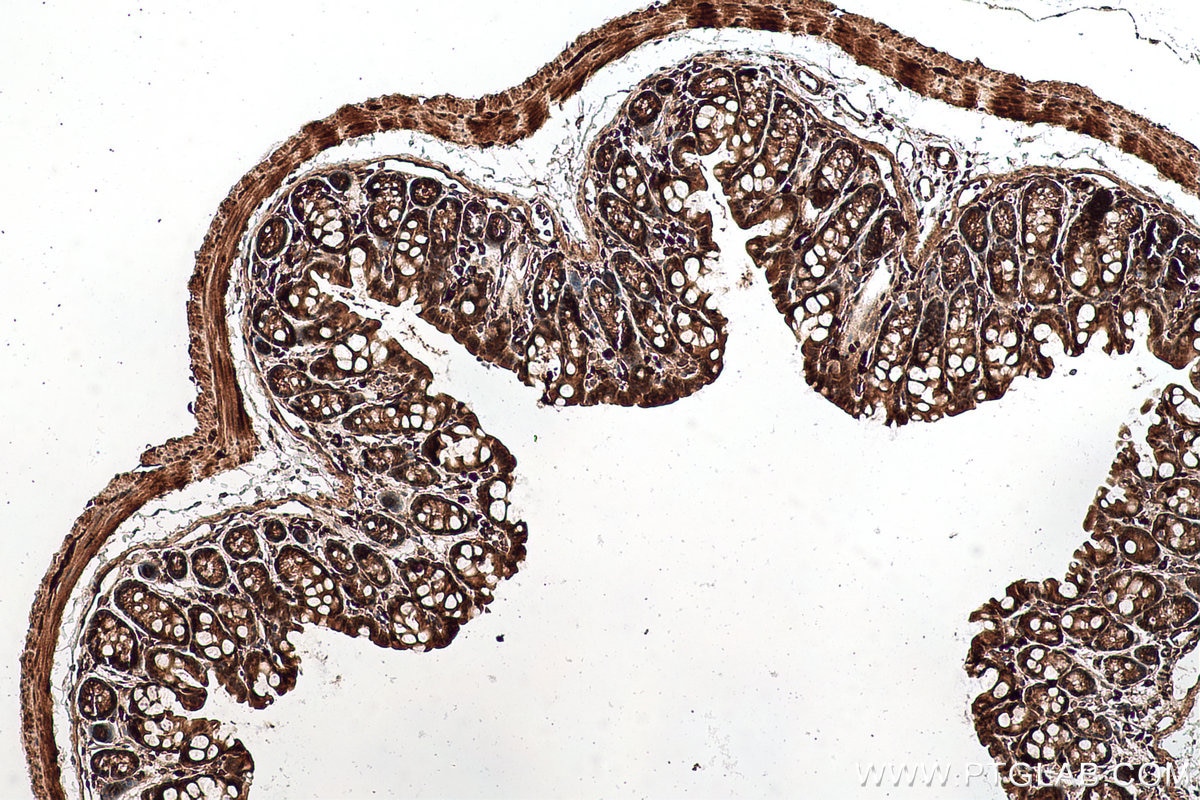 Immunohistochemical analysis of paraffin-embedded mouse colon tissue slide using KHC0761 (STAT3 IHC Kit).