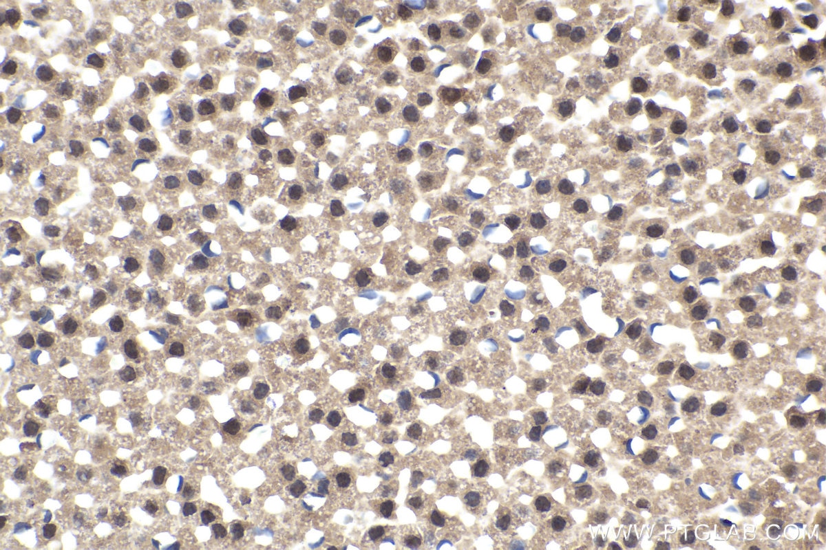 Immunohistochemical analysis of paraffin-embedded rat adrenal gland tissue slide using KHC1594 (STAT5A IHC Kit).