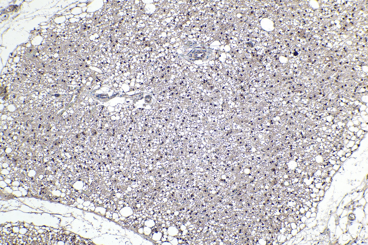 Immunohistochemical analysis of paraffin-embedded rat brown adipose tissue slide using KHC1594 (STAT5A IHC Kit).