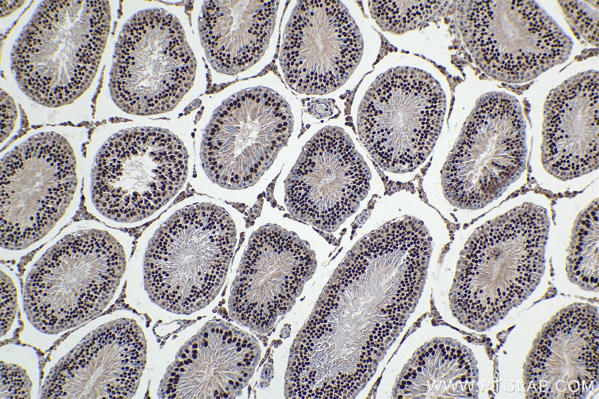 Immunohistochemical analysis of paraffin-embedded rat testis tissue slide using KHC1594 (STAT5A IHC Kit).