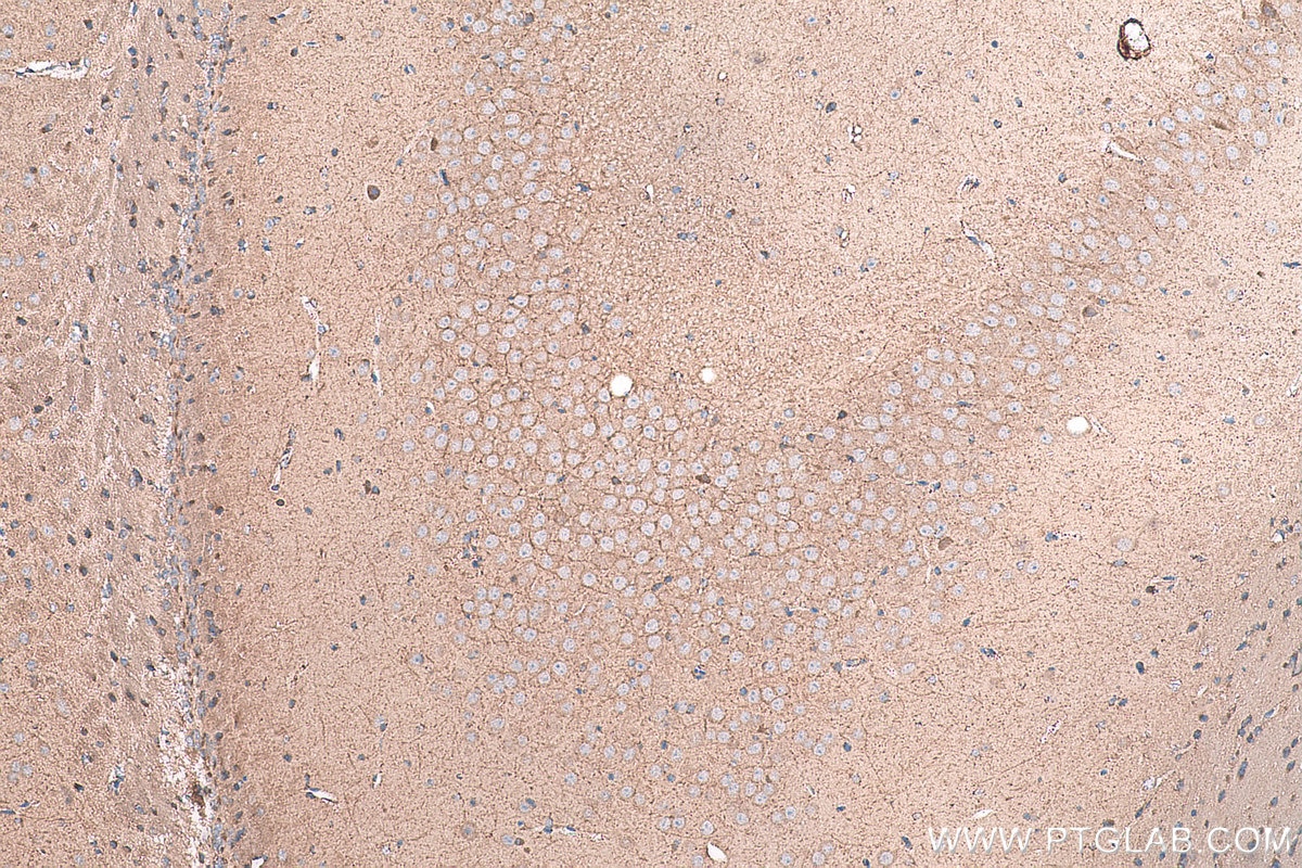 Immunohistochemical analysis of paraffin-embedded mouse brain tissue slide using KHC0985 (STAU1 IHC Kit).