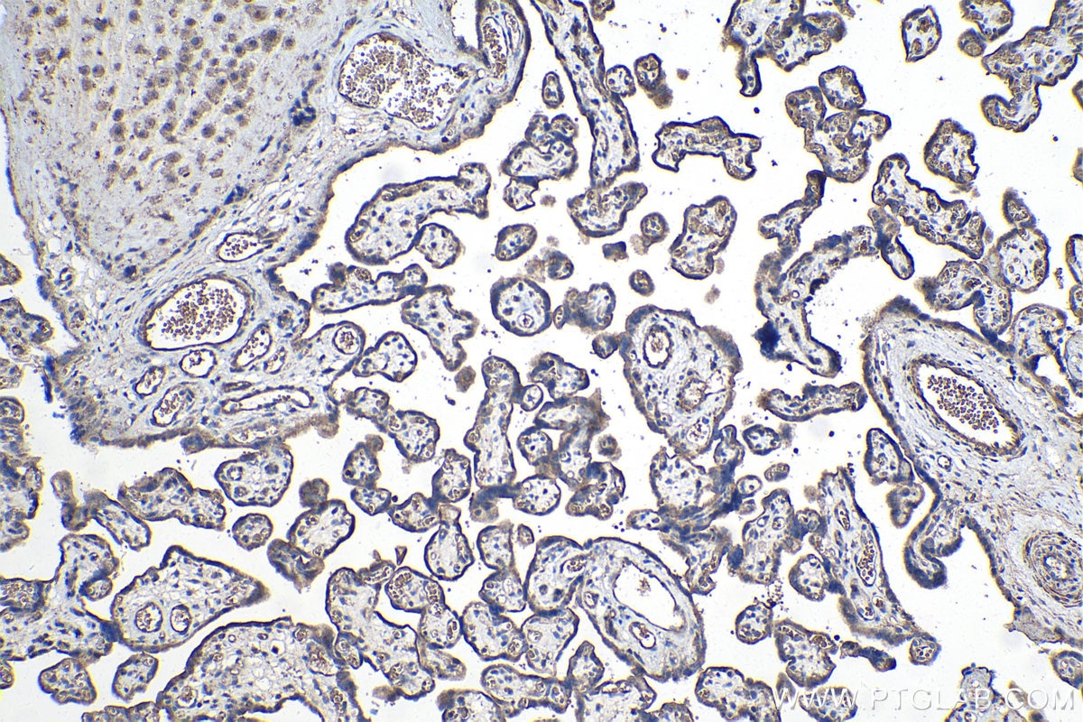 Immunohistochemical analysis of paraffin-embedded human placenta tissue slide using KHC0985 (STAU1 IHC Kit).