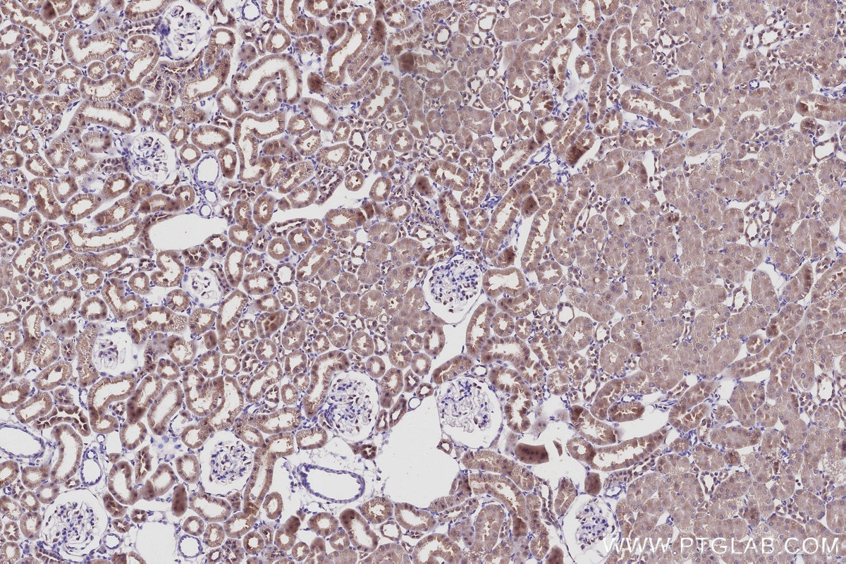 Immunohistochemical analysis of paraffin-embedded rat kidney tissue slide using KHC2955 (STAU2 IHC Kit).