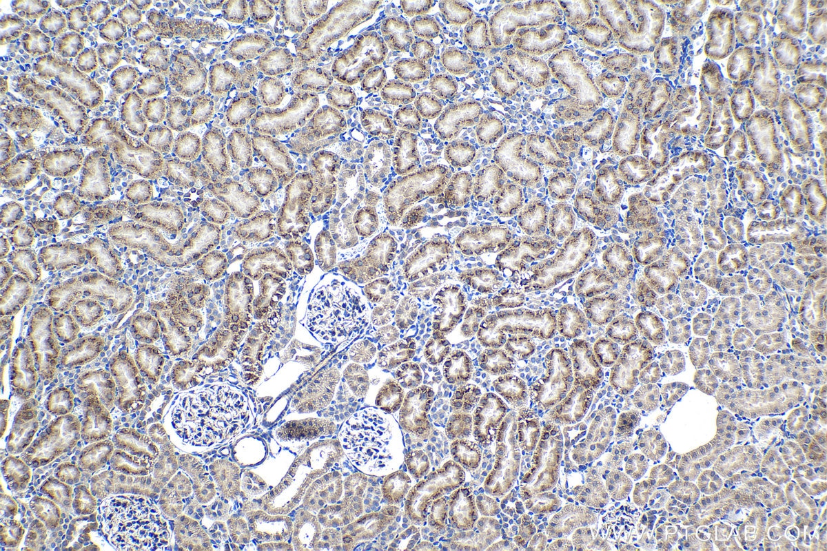 Immunohistochemical analysis of paraffin-embedded rat kidney tissue slide using KHC1346 (STC2 IHC Kit).
