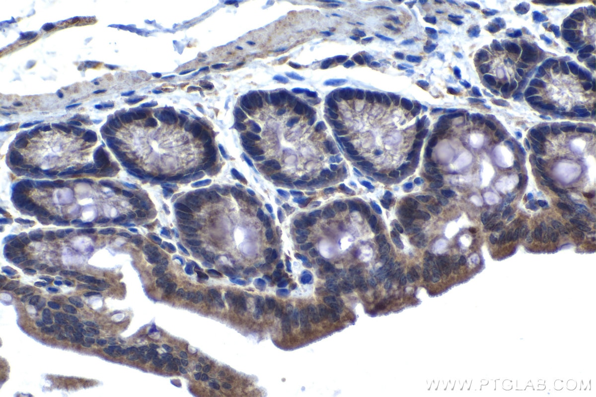 Immunohistochemical analysis of paraffin-embedded mouse colon tissue slide using KHC1346 (STC2 IHC Kit).