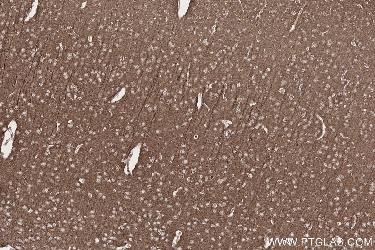 Immunohistochemical analysis of paraffin-embedded rat brain tissue slide using KHC3300 (STEAP2 IHC Kit).