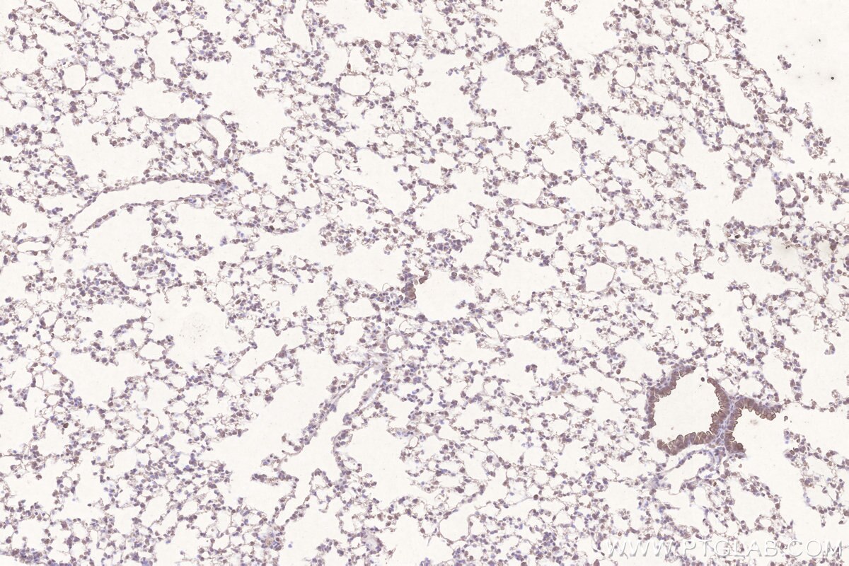 Immunohistochemical analysis of paraffin-embedded mouse lung tissue slide using KHC3267 (STEAP4 IHC Kit).