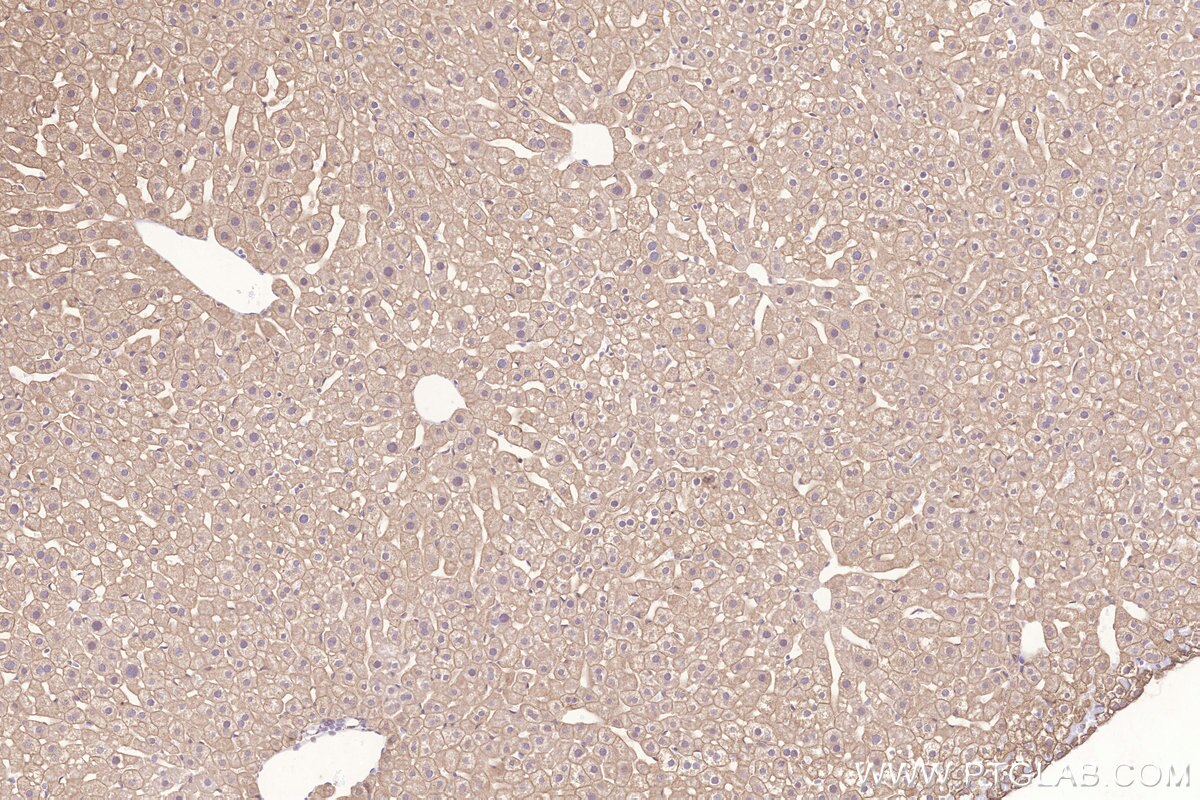 Immunohistochemical analysis of paraffin-embedded mouse liver tissue slide using KHC3267 (STEAP4 IHC Kit).