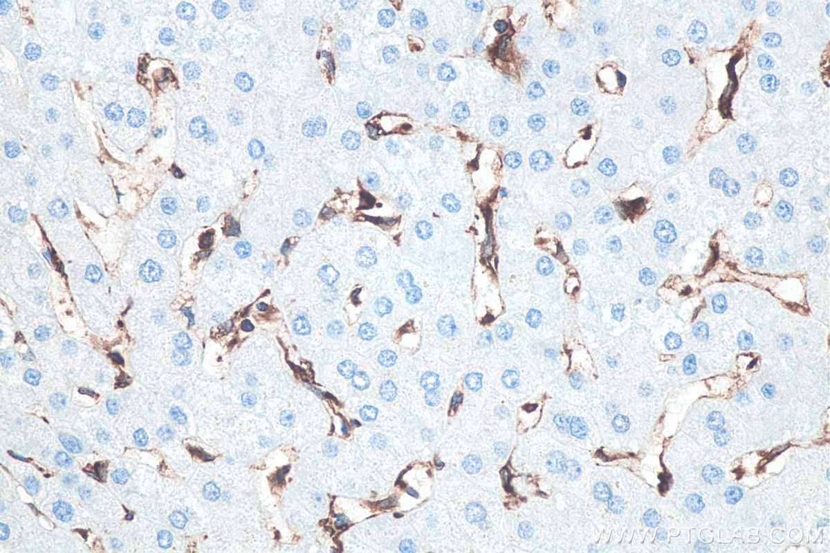 Immunohistochemical analysis of paraffin-embedded human liver tissue slide using KHC0060 (STING IHC Kit).