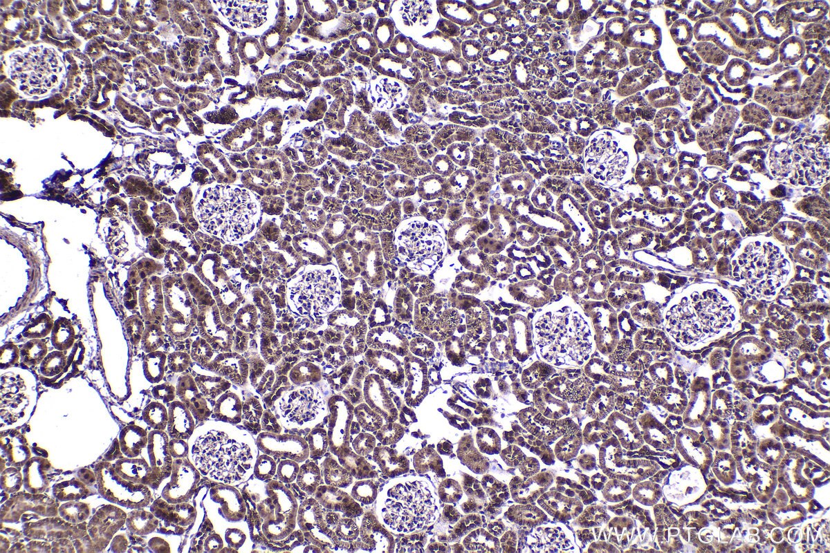 Immunohistochemical analysis of paraffin-embedded rat kidney tissue slide using KHC2237 (STIP1 IHC Kit).