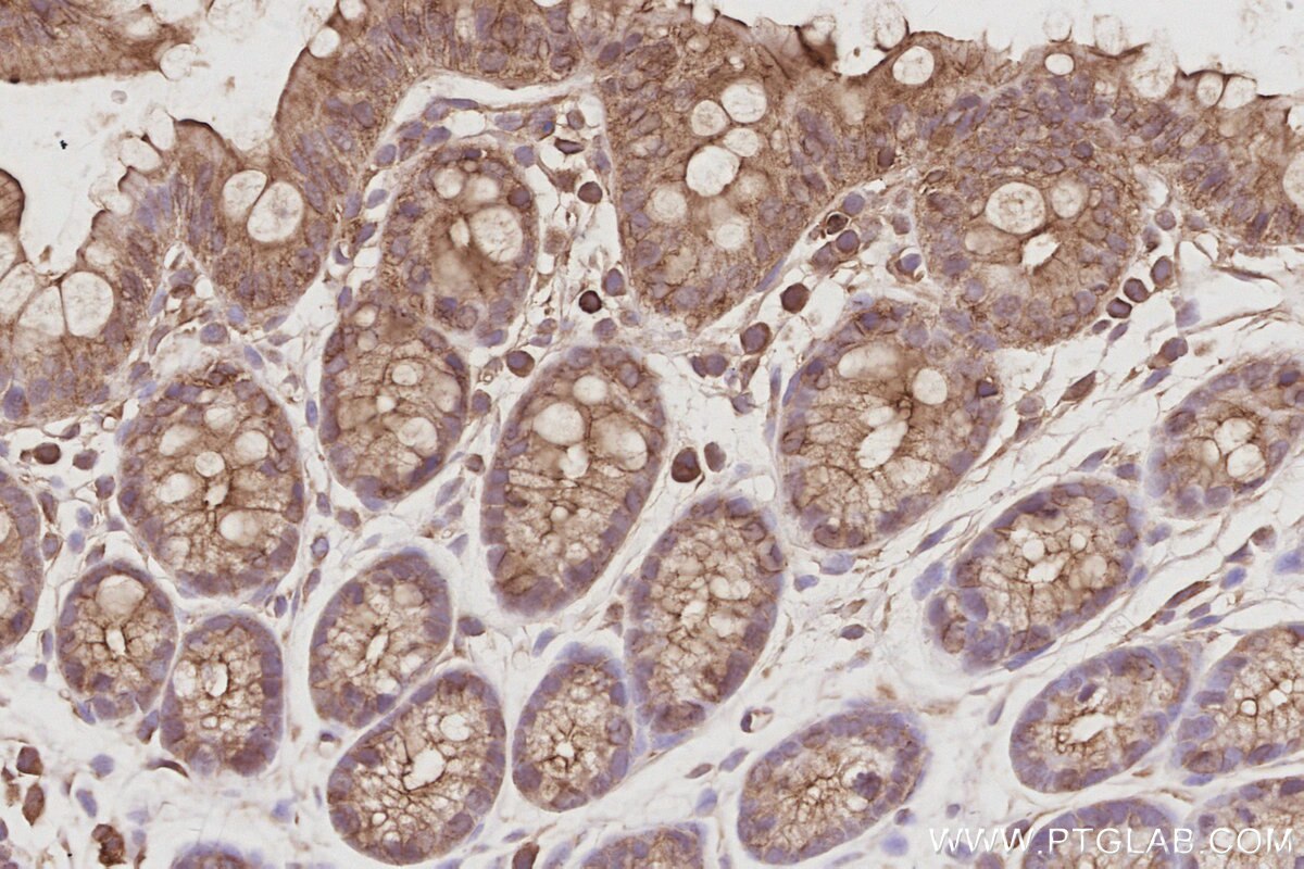 Immunohistochemical analysis of paraffin-embedded mouse colon tissue slide using KHC3090 (STK24 IHC Kit). Immunohistochemical analysis of paraffin-embedded mouse colon tissue slide using KHC3090 (STK24 IHC Kit).