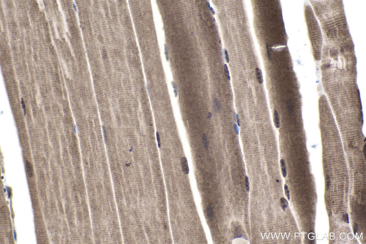 Immunohistochemical analysis of paraffin-embedded mouse skeletal muscle tissue slide using KHC1705 (STK3 IHC Kit).