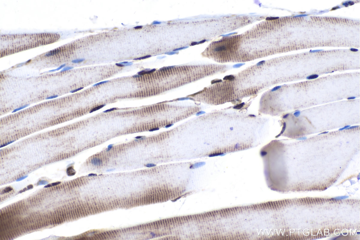 Immunohistochemical analysis of paraffin-embedded rat skeletal muscle tissue slide using KHC1705 (STK3 IHC Kit).