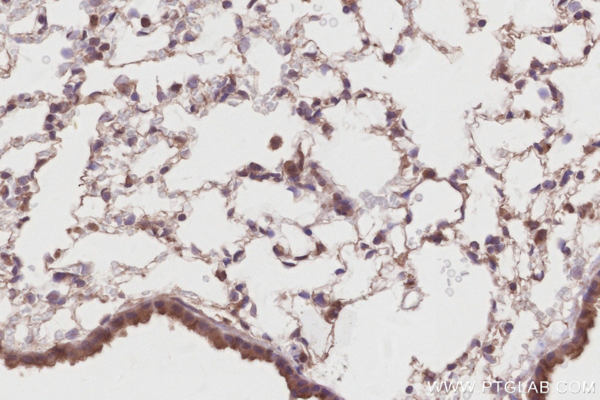 Immunohistochemical analysis of paraffin-embedded mouse lung tissue slide using KHC2888 (STK33 IHC Kit). Immunohistochemical analysis of paraffin-embedded mouse lung tissue slide using KHC2888 (STK33 IHC Kit).