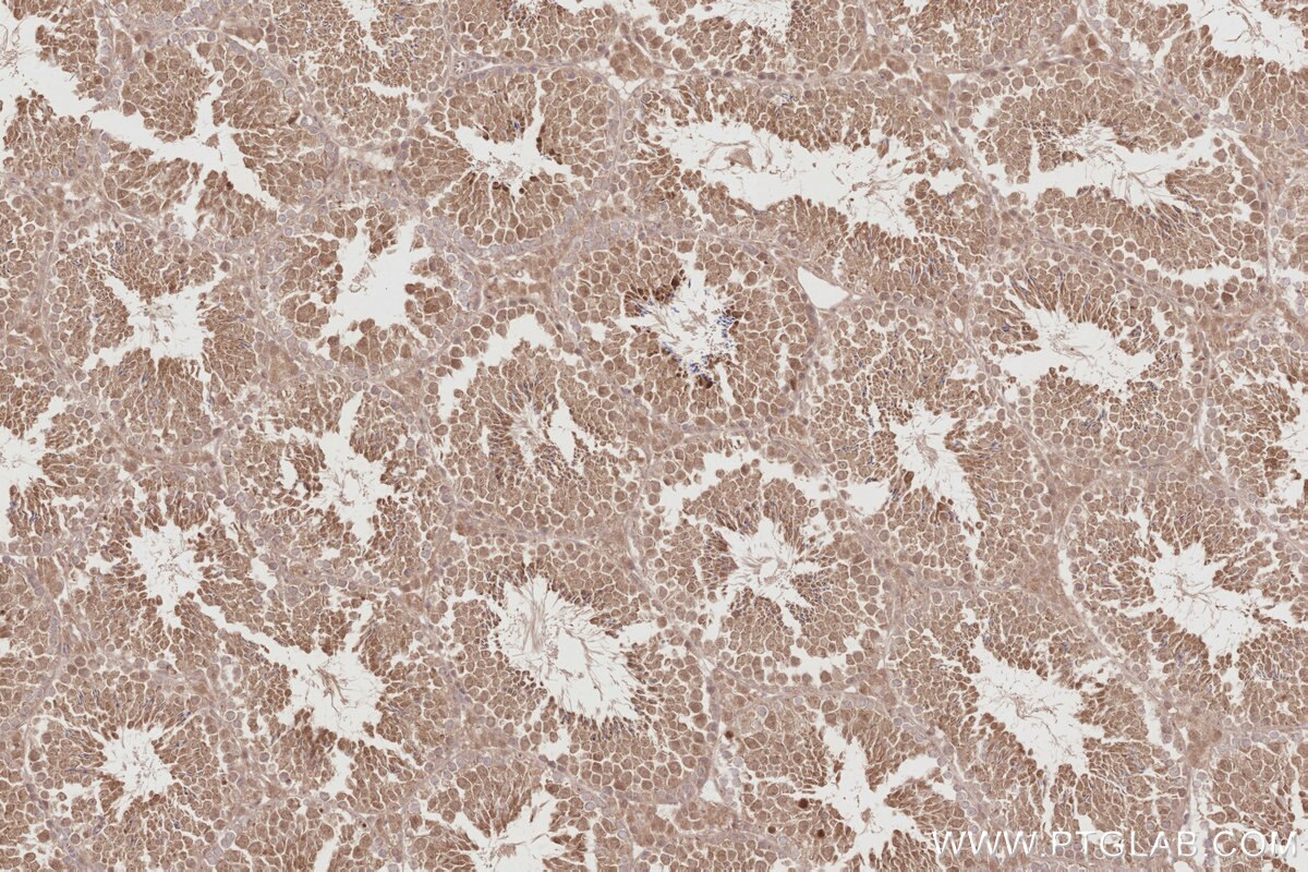 Immunohistochemical analysis of paraffin-embedded mouse testis tissue slide using KHC2888 (STK33 IHC Kit). Immunohistochemical analysis of paraffin-embedded mouse testis tissue slide using KHC2888 (STK33 IHC Kit).