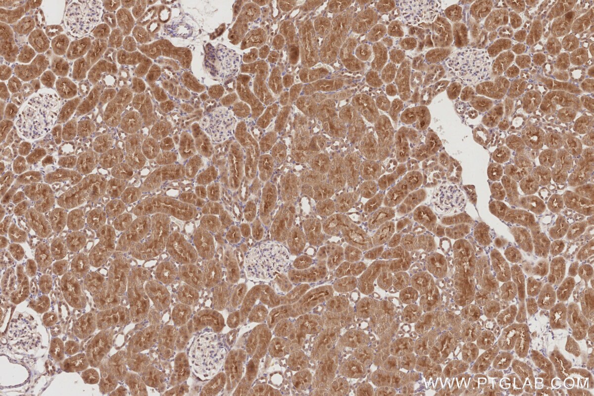 Immunohistochemical analysis of paraffin-embedded rat kidney tissue slide using KHC2888 (STK33 IHC Kit). Immunohistochemical analysis of paraffin-embedded rat kidney tissue slide using KHC2888 (STK33 IHC Kit).