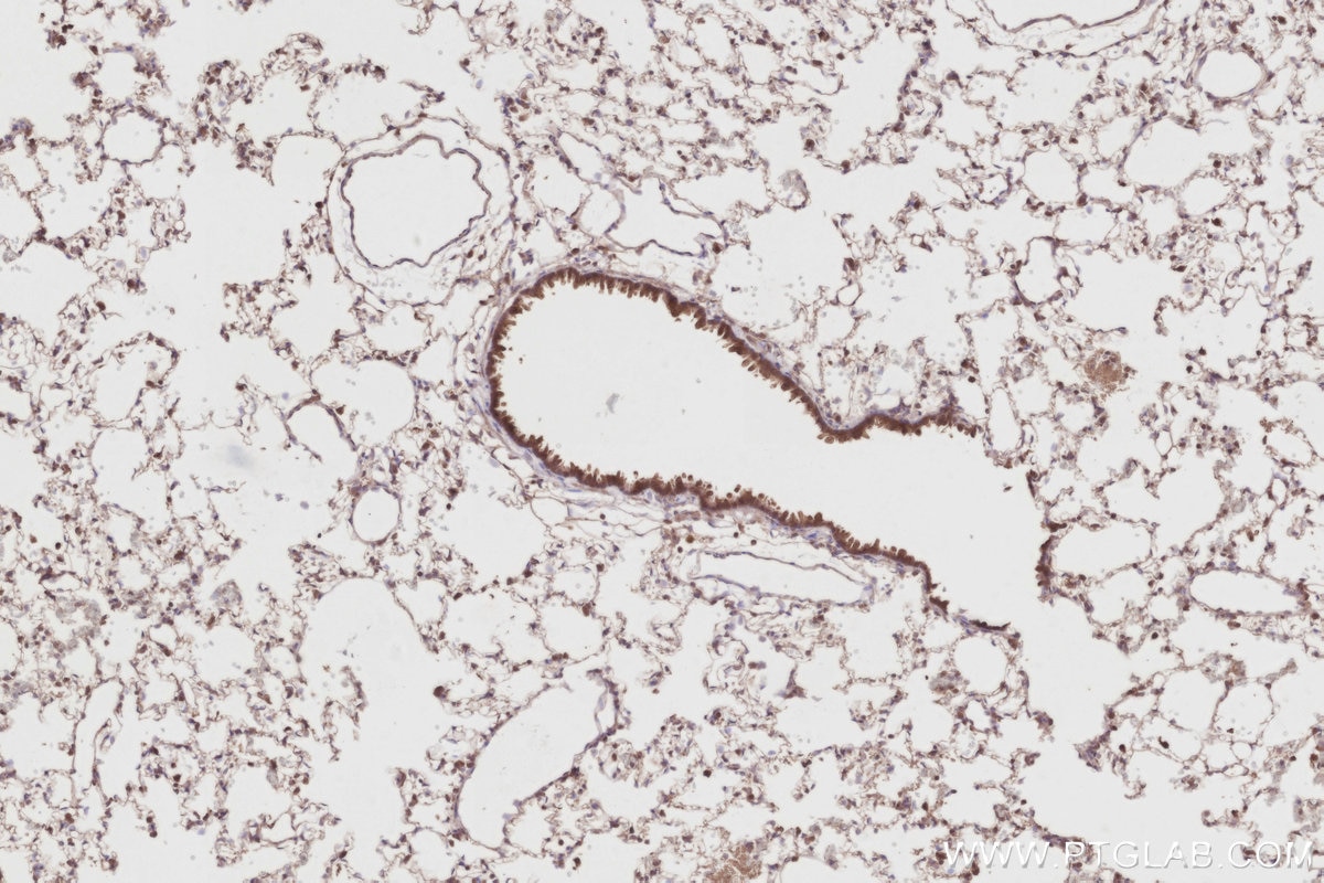 Immunohistochemical analysis of paraffin-embedded rat lung tissue slide using KHC2888 (STK33 IHC Kit). Immunohistochemical analysis of paraffin-embedded rat lung tissue slide using KHC2888 (STK33 IHC Kit).