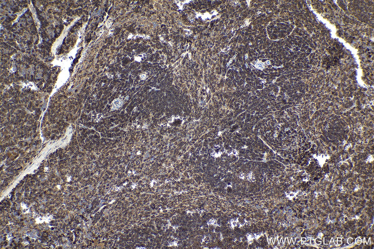 Immunohistochemical analysis of paraffin-embedded mouse spleen tissue slide using KHC1699 (STK4 IHC Kit).