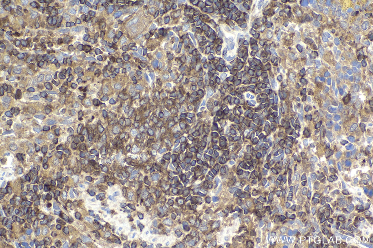 Immunohistochemical analysis of paraffin-embedded rat spleen tissue slide using KHC1699 (STK4 IHC Kit).