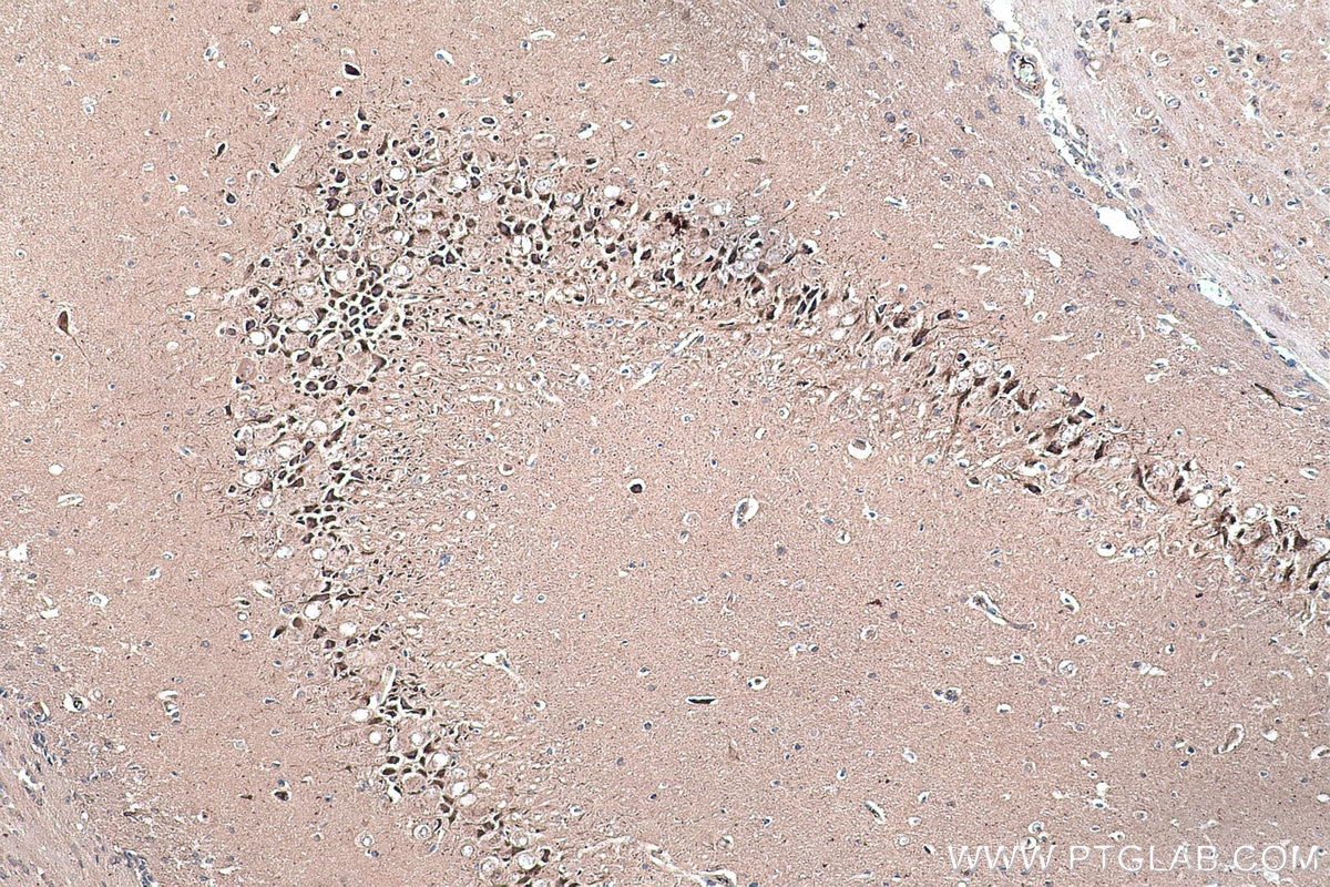 Immunohistochemical analysis of paraffin-embedded rat brain tissue slide using KHC0300 (STMN2 IHC Kit).