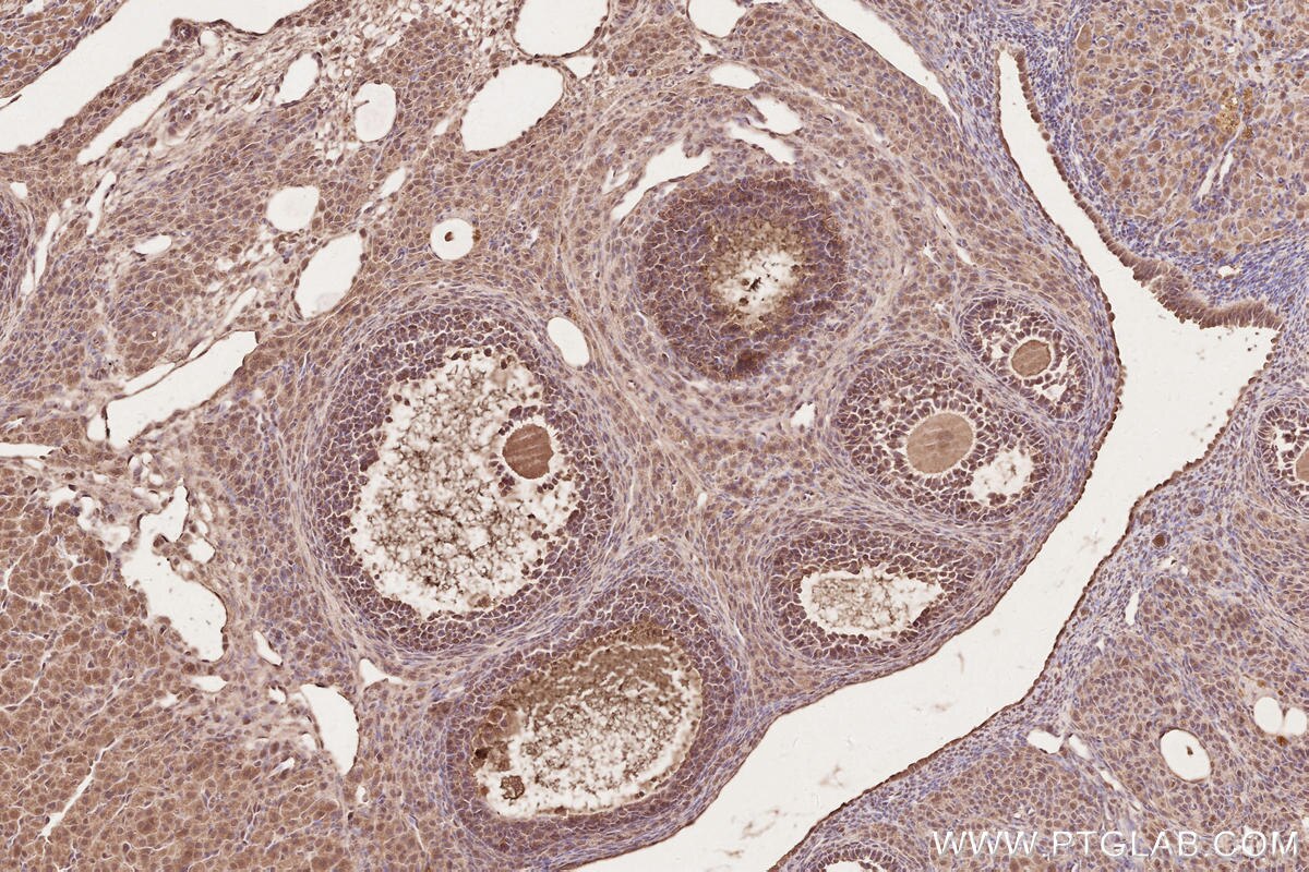 Immunohistochemical analysis of paraffin-embedded rat ovary tissue slide using KHC2628 (STRA8 IHC Kit).
