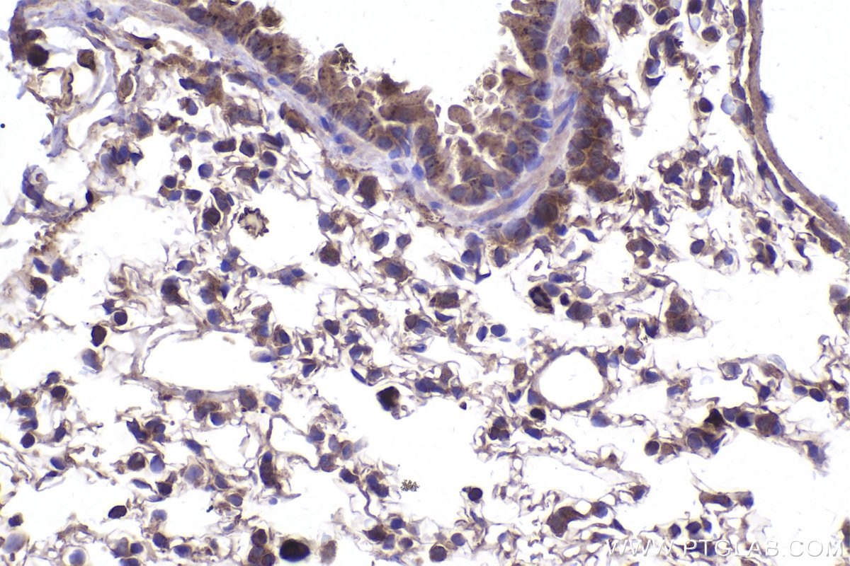 Immunohistochemical analysis of paraffin-embedded mouse lung tissue slide using KHC2020 (STRAP IHC Kit).