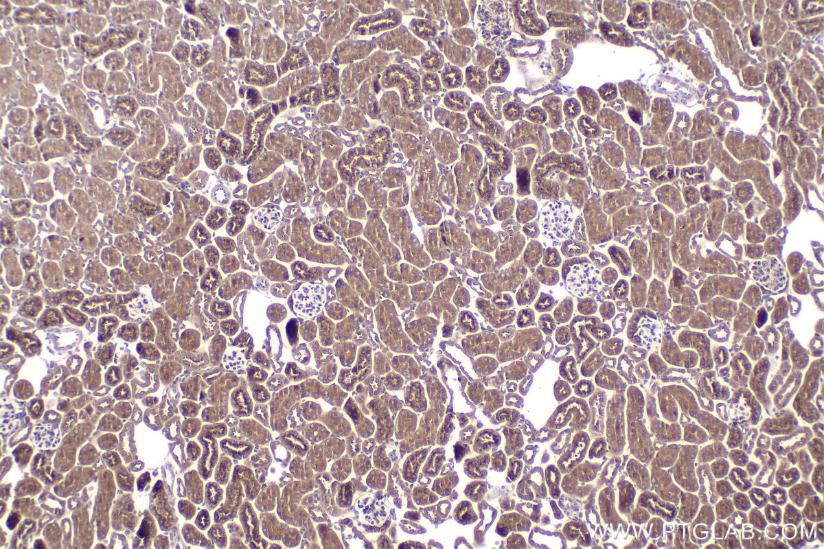 Immunohistochemical analysis of paraffin-embedded mouse kidney tissue slide using KHC2020 (STRAP IHC Kit).