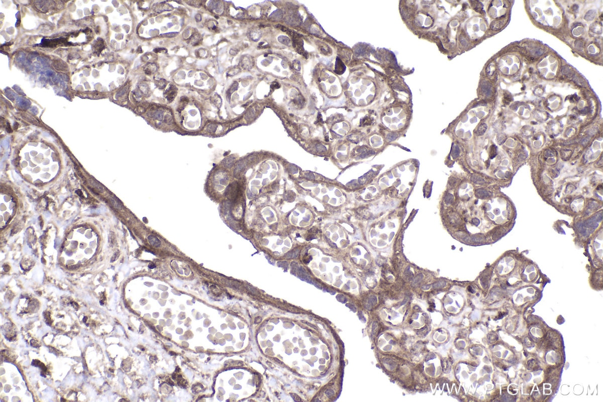 Immunohistochemical analysis of paraffin-embedded human placenta tissue slide using KHC2003 (STUB1 IHC Kit).