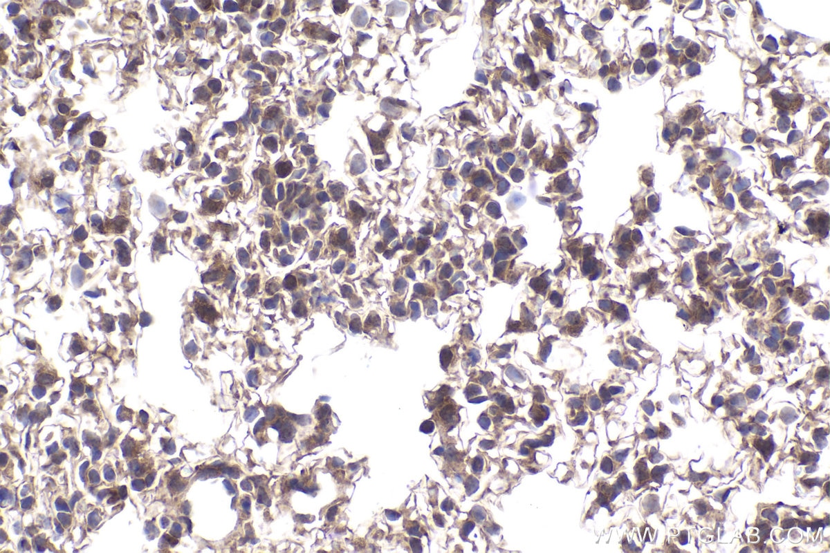 Immunohistochemical analysis of paraffin-embedded mouse lung tissue slide using KHC2003 (STUB1 IHC Kit).