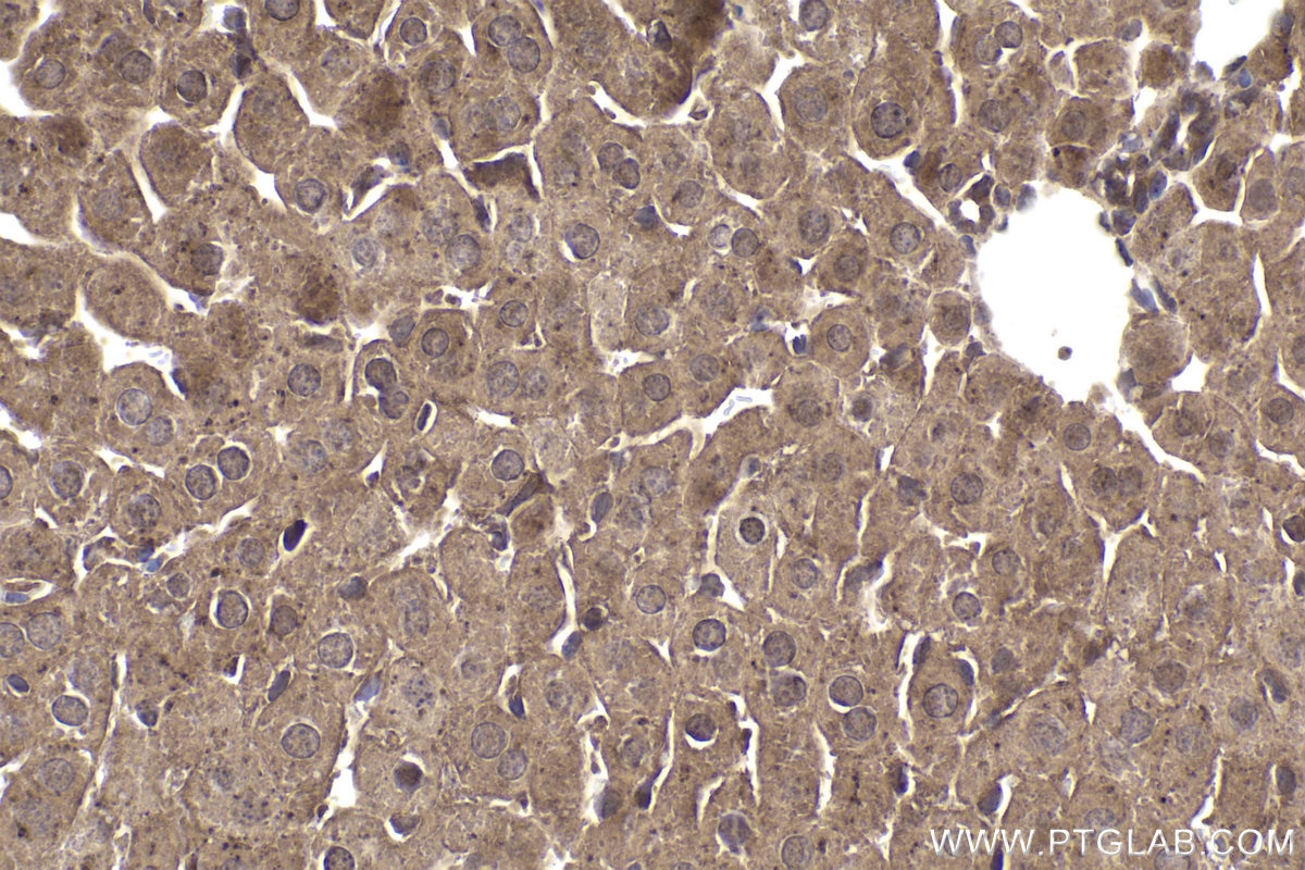 Immunohistochemical analysis of paraffin-embedded mouse liver tissue slide using KHC2003 (STUB1 IHC Kit).