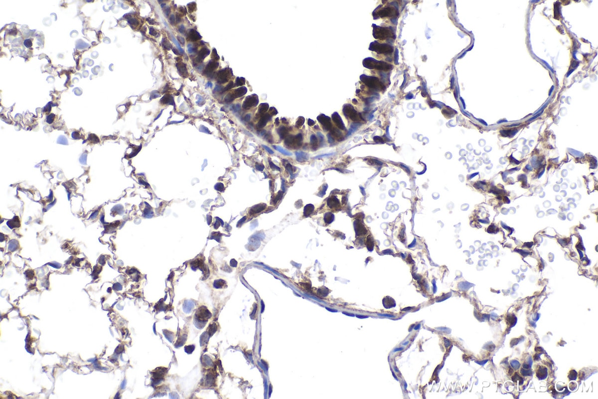 Immunohistochemical analysis of paraffin-embedded rat lung tissue slide using KHC2003 (STUB1 IHC Kit).