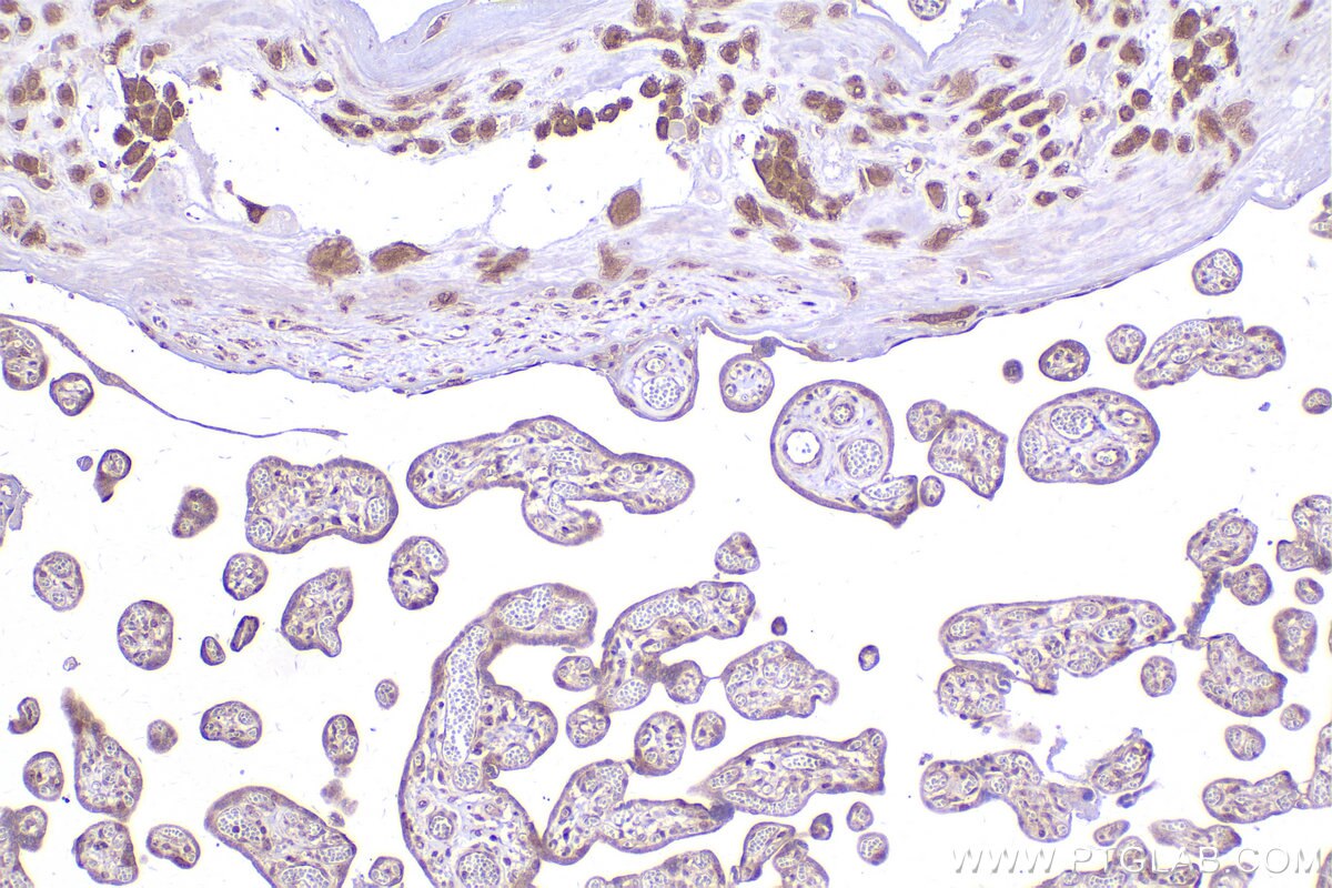 Immunohistochemical analysis of paraffin-embedded human placenta tissue slide using KHC2422 (STX5 IHC Kit).
