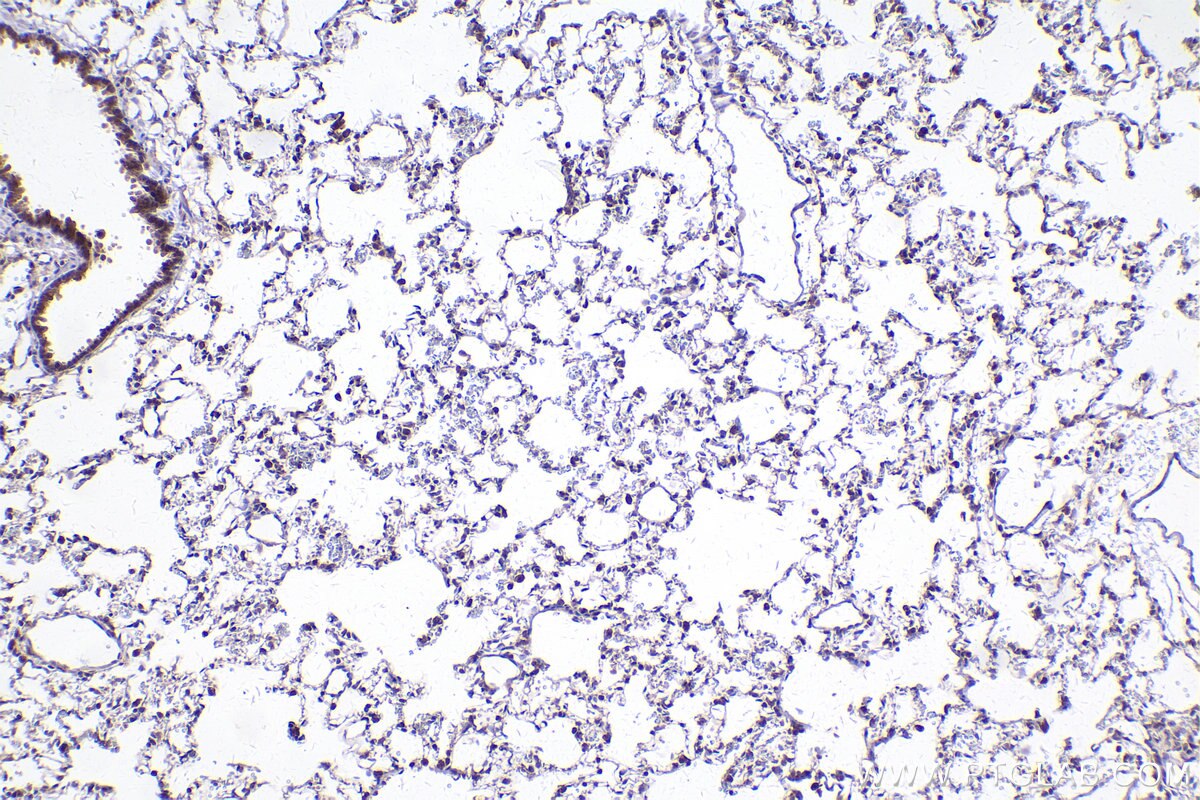 Immunohistochemical analysis of paraffin-embedded rat lung tissue slide using KHC2422 (STX5 IHC Kit).