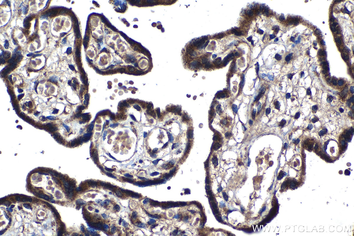 Immunohistochemical analysis of paraffin-embedded human placenta tissue slide using KHC1231 (SULF2 IHC Kit).