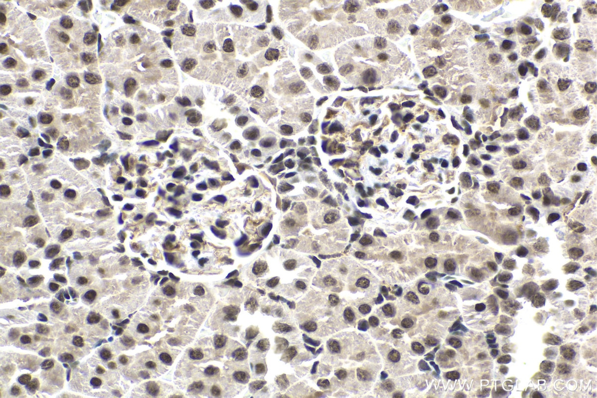 Immunohistochemical analysis of paraffin-embedded rat kidney tissue slide using KHC1649 (SUMO1 IHC Kit).