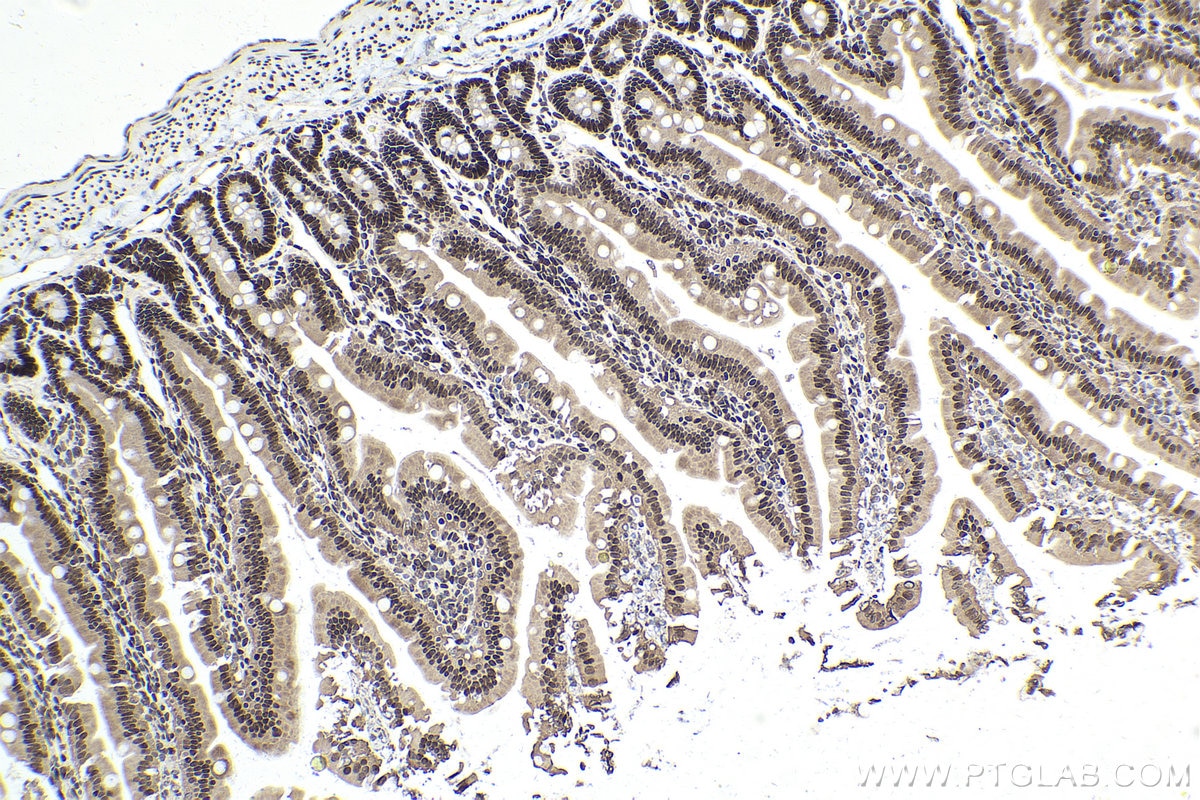 Immunohistochemical analysis of paraffin-embedded rat small intestine tissue slide using KHC1649 (SUMO1 IHC Kit).