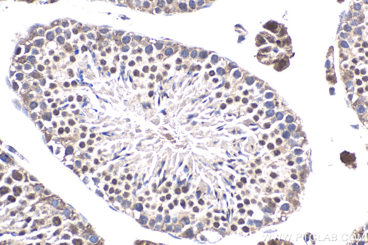 Immunohistochemical analysis of paraffin-embedded mouse testis tissue slide using KHC1836 (SUPT20H/FAM48A IHC Kit).